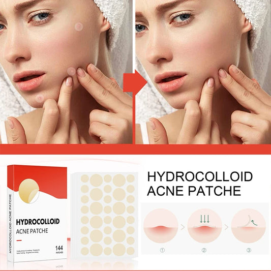 Hydrocolloid Acne Pimple Patch for Overnight Healing