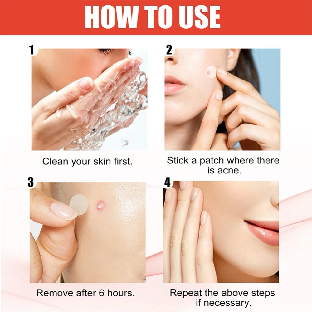 Hydrocolloid Acne Pimple Patch for Overnight Healing