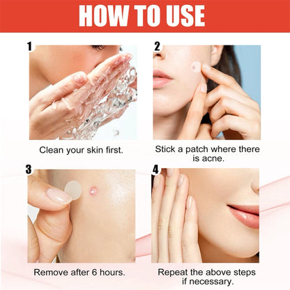Hydrocolloid Acne Pimple Patch for Overnight Healing