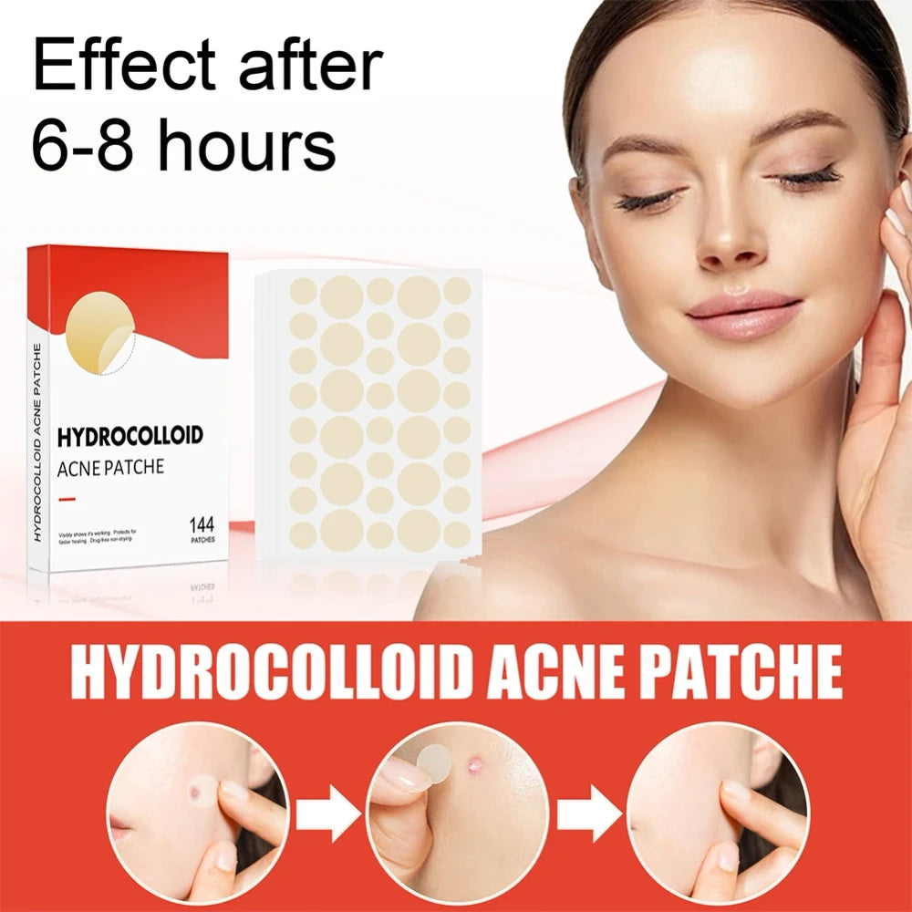 Hydrocolloid Acne Pimple Patch for Overnight Healing