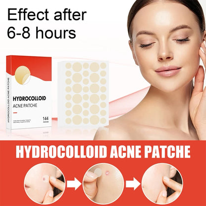 Hydrocolloid Acne Pimple Patch for Overnight Healing