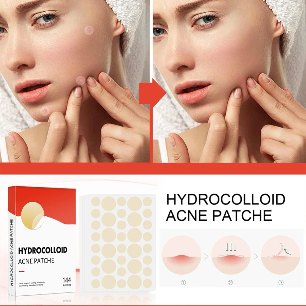 Hydrocolloid Acne Pimple Patch for Overnight Healing