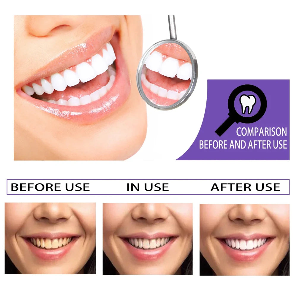 Teeth Whitening Foam for Coffee Stains