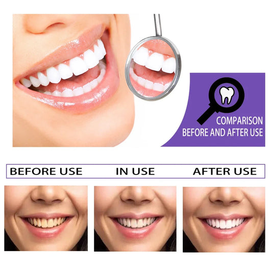 Teeth Whitening Foam for Coffee Stains