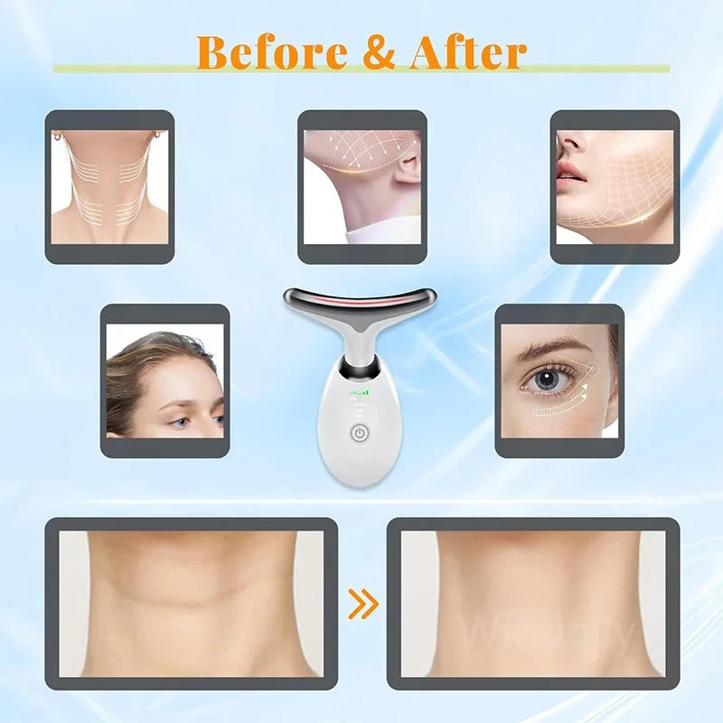Neck Beauty Device